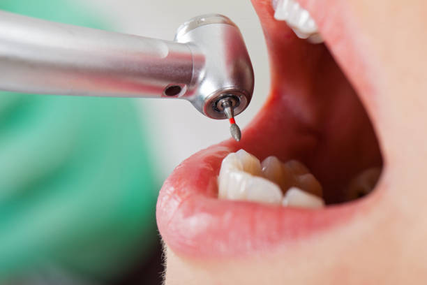 Best Pediatric Emergency Dentist in Buckner, KY